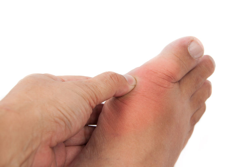 artrose nos dedos dos pés